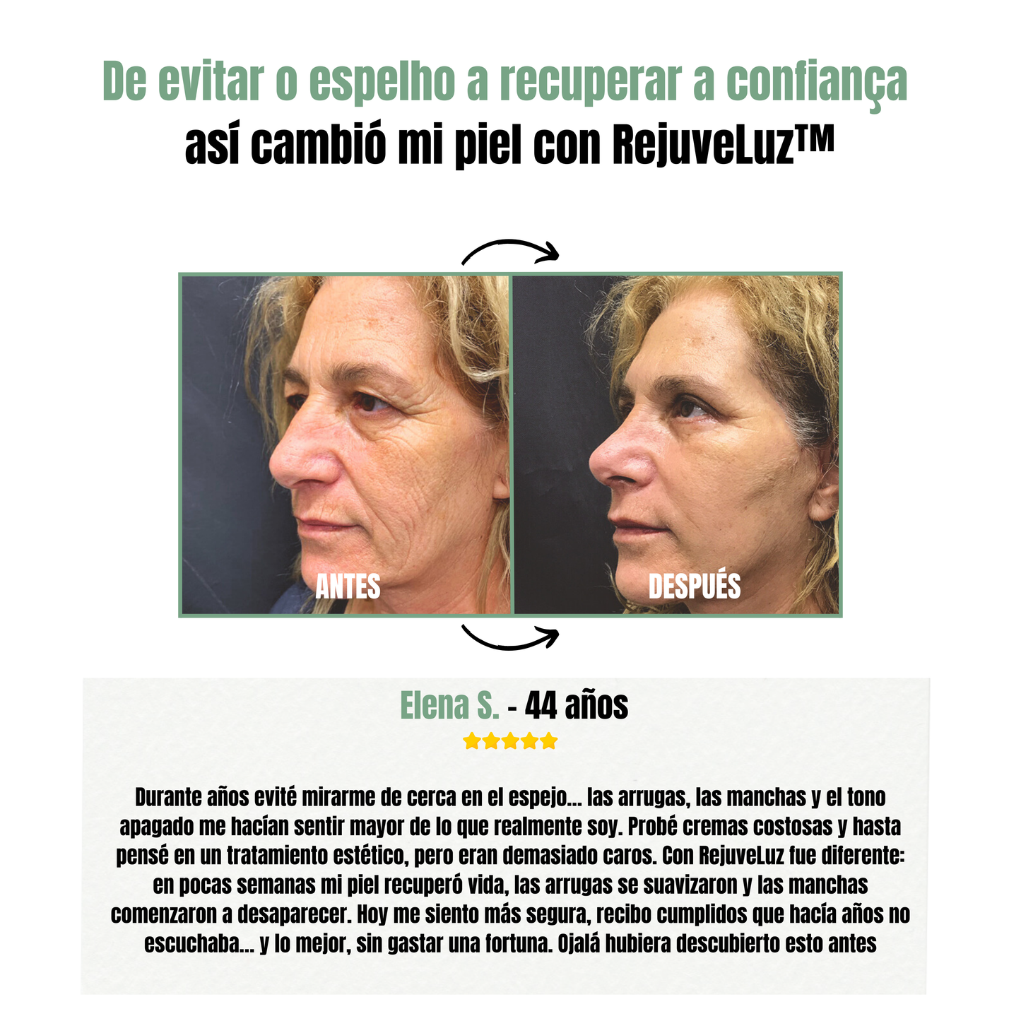 RejuveLuz™ - Masajeador